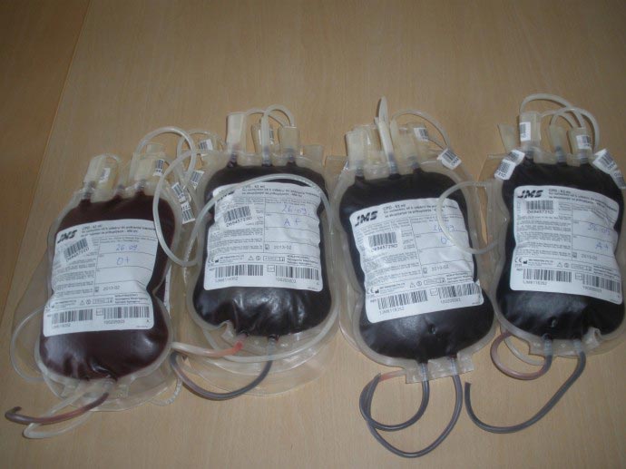 kako darivati krv